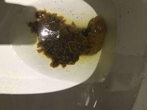 吃瓜大便不成型,揭秘“吃瓜大便不成型”背后的健康秘密  第1张